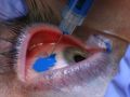 Scarification, tongue splitting...